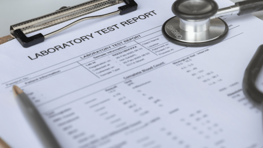 Für eine hohe Aussagekraft können mehrere Longevity-Tests kombiniert werden.
