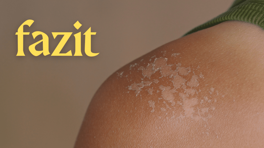 Fazit zu After-sun-Creme mit CBD
